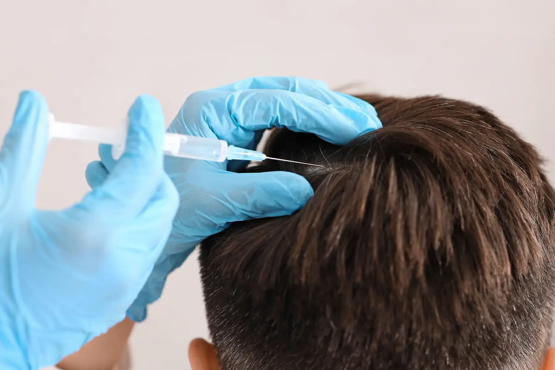 Gloved hands administering a syringe injection into a patient's scalp