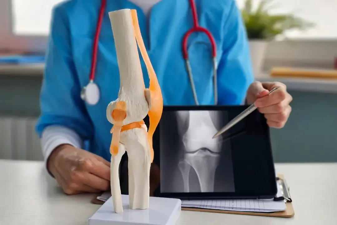 Doctor holding knee X-ray tablet beside anatomical knee joint model